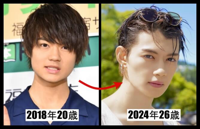 佐野勇斗の20歳のときと現在の顔が変わった画像の比較