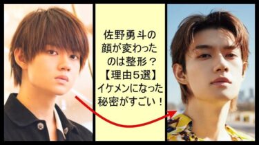 佐野勇斗の顔が変わったのは整形？理由５選！イケメンになった秘密がすごい！